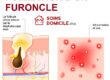 Furoncle purulent soins à domicile